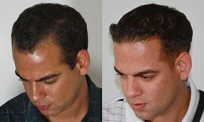 Centre de Greffe de Cheveux & Chirurgie Plastique