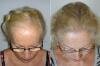 Centre de Greffe de Cheveux & Chirurgie Plastique